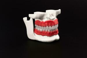 menselijk kaak met tanden en tandvlees anatomie model- geïsoleerd Aan blauw achtergrond. gezond tanden, tandheelkundig zorg en orthodontisch medisch gezondheidszorg concept foto