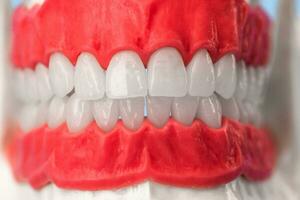 menselijk kaak met tanden en tandvlees anatomie model- geïsoleerd Aan blauw achtergrond. gezond tanden, tandheelkundig zorg en orthodontisch medisch gezondheidszorg concept foto
