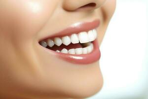 perfect gezond tanden glimlach van een jong vrouw Bij een tandarts. tanden bleken. tandheelkundig zorg, stomatologie concept door ai gegenereerd foto