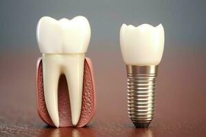 dichtbij omhoog van een tandheelkundig tand implantaat of gezond menselijk tanden. wit glazuur en tandheelkundig implantaten chirurgie concept door ai gegenereerd foto