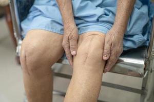 Aziatische senior vrouw patiënt laat haar littekens zien chirurgische totale knie foto