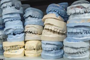 magazijn van gips modellen van menselijk kaken in een orthodontisch kliniek. controle en diagnostisch tandheelkundig afgietsels voor uitlijners. foto