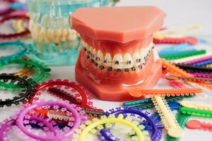 orthodontisch ligaturen ringen en banden, elastisch rubber bands Aan orthodontisch een beugel, model- voor tandarts aan het studeren over tandheelkunde. foto