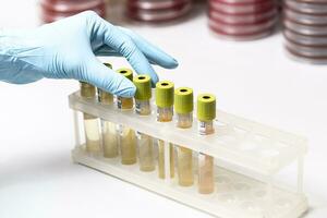 test buizen met geel vloeistof in de laboratorium foto
