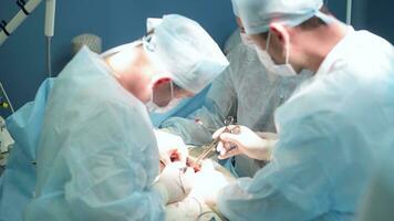 een zeer gekwalificeerd team van chirurgen presteert een complex operatie naar verwijderen een alvleesklier cyste gebruik makend van medisch instrumenten foto