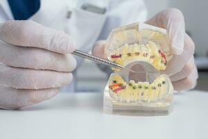 dokter orthodontist shows hoe de systeem van een beugel Aan tanden is geregeld foto