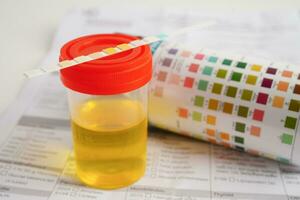 urineonderzoek, urine kop met reagens strip ph papier test en vergelijking tabel in laboratorium. foto