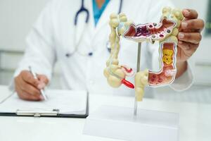 darm, dokter Holding anatomie model- voor studie diagnose en behandeling in ziekenhuis. foto