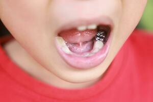 kind melk tanden vallen uit van gom. weinig jongen blijvend tand groeit in mond. schattig kind Open haar mond tonen tandheelkundig kroon en tandvlees. concept van Gezondheid, tandarts, hygiëne, medisch, gezond tanden, kliniek. foto
