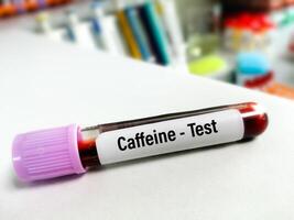 wetenschapper Holding monster voor cafeïne bloed test foto