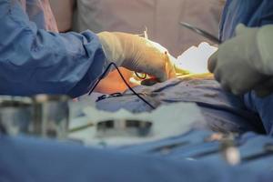 close-up van de handen van de dokter die met zijn medisch team in een operatiekamer werkt. foto