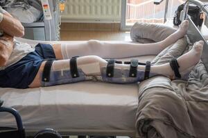 een Mens met een gebroken been in een orthese Aan een bed in een kliniek na een ongeluk en een breuk van de dijbeen foto