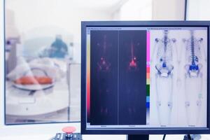 isotoop studie in de laboratorium van berekend tomografie. radioactief studie Aan de detectie van bot kanker foto