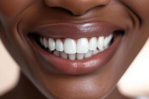 ai gegenereerd Afrikaanse vrouw gezicht met breed grijns perfect schoon tanden. gezond glimlach. generatief ai foto