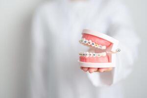 tandarts met orthodontisch tand model- en haakje of beugel. schoon en schrapen uit tandsteen. mei orthodontisch Gezondheid dag, maart mondeling Gezondheid, tandarts dag, false tanden. kiespijn en kinderen tandheelkundig Gezondheid foto