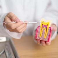 tandarts met tand anatomie model. mondeling tanden verval en ziekte, schrapen uit tandsteen. maart mondeling Gezondheid, tandarts dag, false tanden. kiespijn en kinderen tandheelkundig Gezondheid maand en orthodontisch Gezondheid dag foto