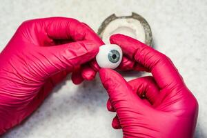 oogarts of chirurg houdt een kunstmatig oog, oogbol prothese in handen. concept foto voor oculair prothese. chirurgisch operaties Aan ogen. detailopname.