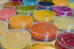 ai gegenereerd Petri gerechten met bacterieel kolonies cultuur Aan agar borden in laboratorium foto