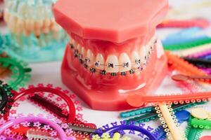 orthodontisch ligaturen ringen en banden, elastisch rubber bands Aan orthodontisch een beugel, model- voor tandarts aan het studeren over tandheelkunde. foto