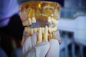 tandarts Holding een kunstmatig lager kaak. tandheelkundig prothese. tand bord. tandheelkundig model- medisch voorwerp voor onderwijs leerling in tandheelkundig zorg school- foto