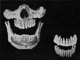 menselijk tanden Aan de kaak en de twee rijen van geïsoleerd tanden, wijnoogst gravure. foto