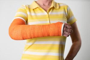 vrouw met een gebroken arm en een oranje gips plastic verband Aan een witte achtergrond, modern materialen voor de behandeling foto