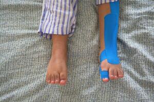 elastisch therapeutisch blauw plakband toegepast naar kind been. kinesio tapen behandeling voor letsel foto