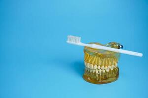 kunstgebit met een tandenborstel Aan een blauw achtergrond.boven en lager kaken met false tanden. kunstgebit of false tanden, detailopname. foto