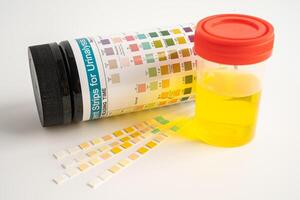 urineonderzoek, urine kop met reagens strip ph papier test en vergelijking tabel in laboratorium. foto