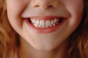 ai gegenereerd kinderen glimlach detailopname met wit Rechtdoor tanden, tandheelkundig zorg concept foto