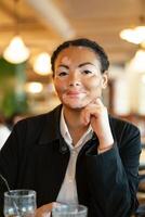 een mooi jong meisje van Afrikaanse etniciteit met vitiligo zittend in een restaurant foto