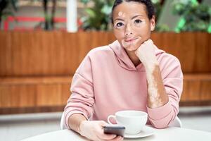 zwart Afrikaanse Amerikaans vrouw met vitiligo pigmentatie huid probleem binnen- gekleed roze capuchon foto