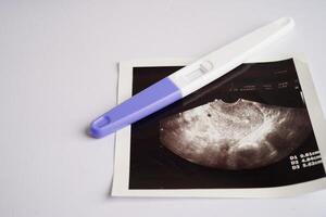 zwangerschap test met echografie scannen foto van foetus, moederschap, bevalling, geboorte controle.