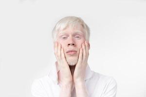 portret van een albino Mens in studio gekleed t-shirt geïsoleerd Aan een wit achtergrond. abnormaal afwijkingen. ongebruikelijk uiterlijk foto