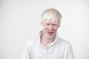 portret van een albino Mens in studio gekleed t-shirt geïsoleerd Aan een wit achtergrond. abnormaal afwijkingen. ongebruikelijk uiterlijk foto