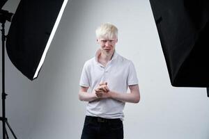 albinisme albino Mens in studio gekleed t-shirt geïsoleerd Aan een wit achtergrond. abnormaal afwijkingen. ongebruikelijk uiterlijk foto