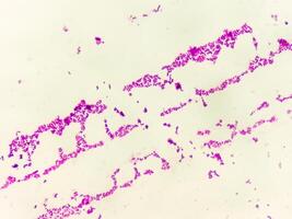 pus gram gebrandschilderd microscopisch tonen gram positief bacteriën. foto