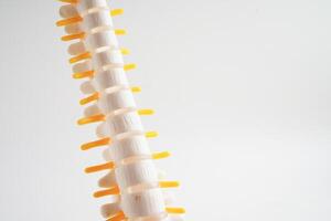 spinal zenuw en bot, lumbaal wervelkolom verplaatst hernia schijf fragment, model- voor behandeling medisch in de orthopedische afdeling. foto