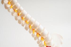 spinal zenuw en bot, lumbaal wervelkolom verplaatst hernia schijf fragment, model- voor behandeling medisch in de orthopedische afdeling. foto