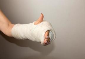 dame met gebroken hand en pols gewikkeld in gips foto