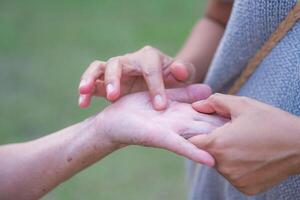 een jong vrouw hand- is aanraken een brok van vlees omhoog de midden- van de palm van een senior vrouw. de brok is abnormaal. bereiden naar gevonden een dokter in de ziekenhuis foto