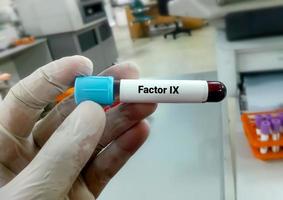 bloedmonster voor factor ix. bloedstolling testen. medisch of gezondheidsconcept. antihemofilie factor b, kerstziekte, factor ix hemofilie foto