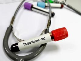 reageerbuis met bloedmonster voor chagas-test, amerikaanse trypanosomiasis. diagnose van de ziekte van Chagas. een medisch testconcept op de laboratoriumachtergrond. foto