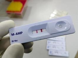 snelle screeningstest voor amfetamine-amp-test. diagnose van illegale drugs amfetamine. foto