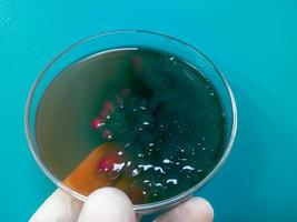 petrischaal met bacteriekolonies. microbiologisch laboratorium. bacterieel onderzoek foto