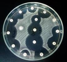 antimicrobiële gevoeligheidstesten in petrischaaltjes. antibioticaresistentie van bacteriën foto
