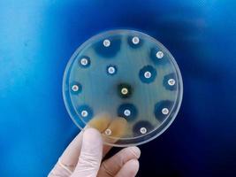 antimicrobiële gevoeligheidstesten in petrischaaltjes. antibioticaresistentie van bacteriën foto