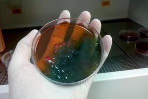 petrischaal met bacteriekolonies. microbiologisch laboratorium. bacterieel onderzoek foto