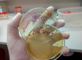 gehandschoende hand van een technicus of wetenschapper die petrischaal vasthoudt op de achtergrond van een microbiologisch laboratorium. bacteriële kweekmedia. microbioloog. bacteriën. foto