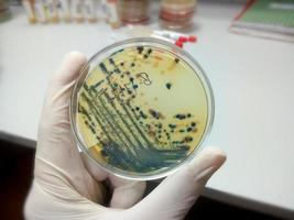 gehandschoende hand van een technicus of wetenschapper die petrischaal vasthoudt op de achtergrond van een microbiologisch laboratorium. bacteriële kweekmedia. microbioloog. bacteriën. foto